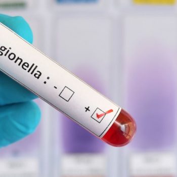 SAVE THE DATE – Legionella: strategie efficaci per la valutazione, la gestione e l’intervento nei rischi